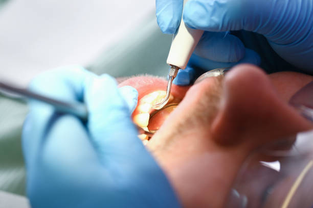 Best Emergency Dental Extractions in Clairton, PA