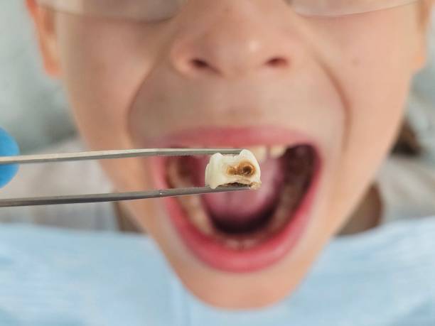 Best Urgent Dental Care for Toothache in Clairton, PA
