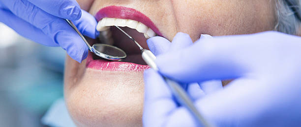 Best Emergency Dentist for Lost Fillings or Crowns in Clairton, PA